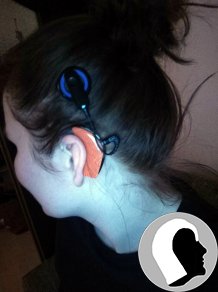 CI Kopf 2018 Erwachsen